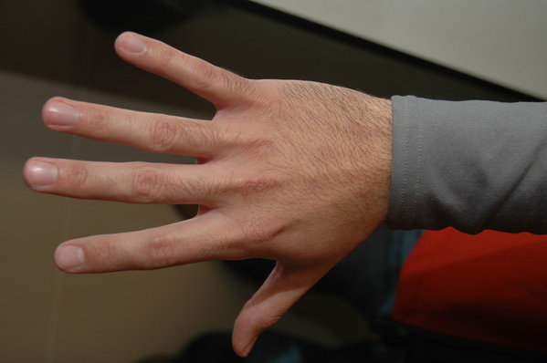 Zimmerman's right hand